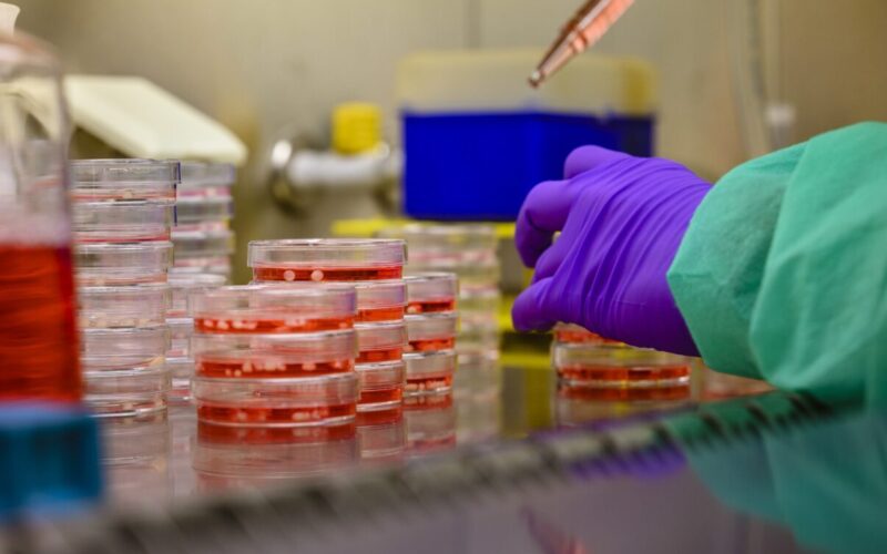 Petridishes with organoids are being tested.