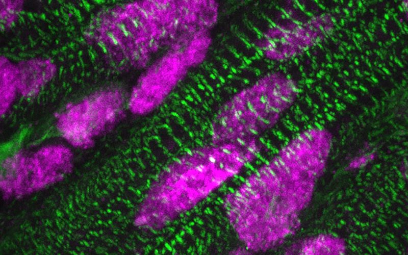 Presence of ARID1A (pink) in the cell nuclei of heart muscle cells (green), a few days after birth.