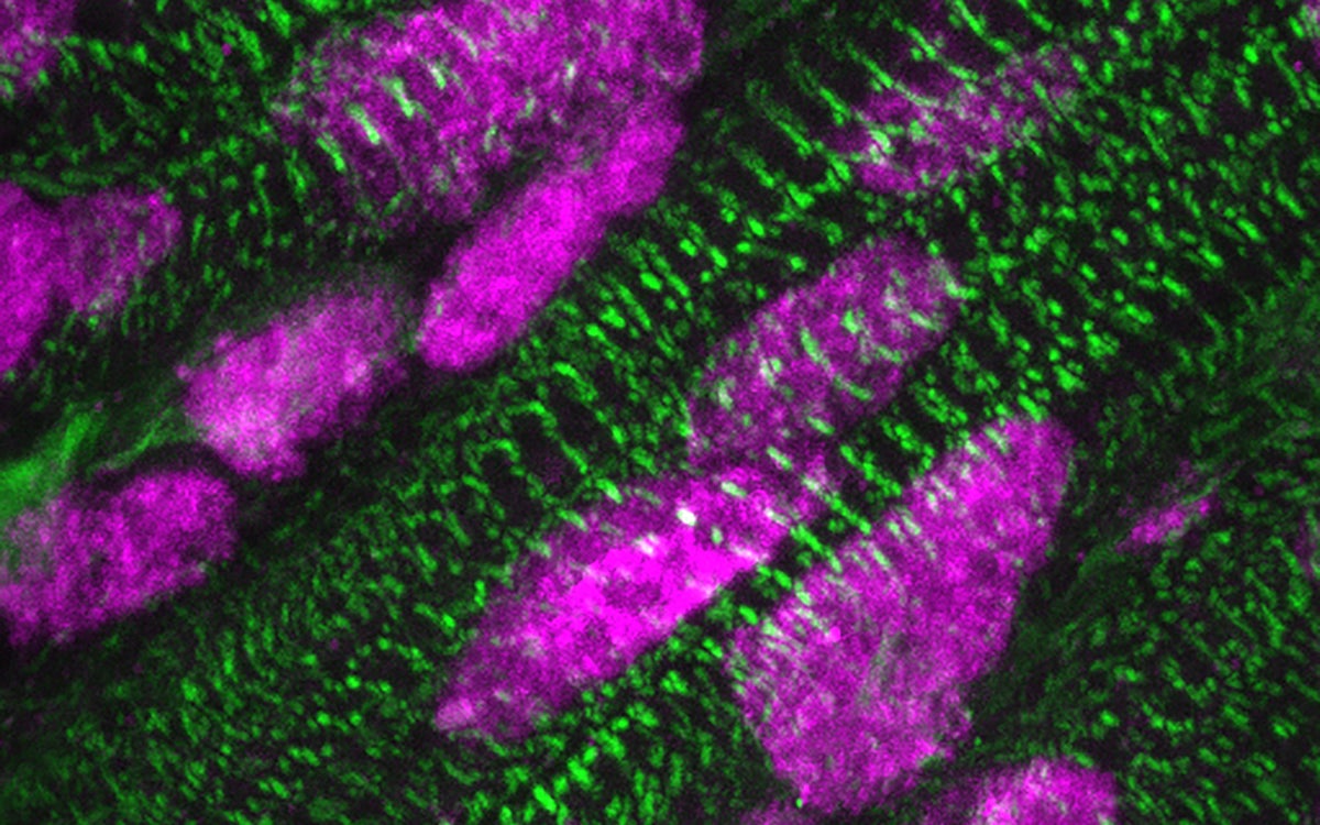 Presence of ARID1A (pink) in the cell nuclei of heart muscle cells (green), a few days after birth.