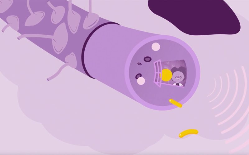 Cartoon blood brain barrier