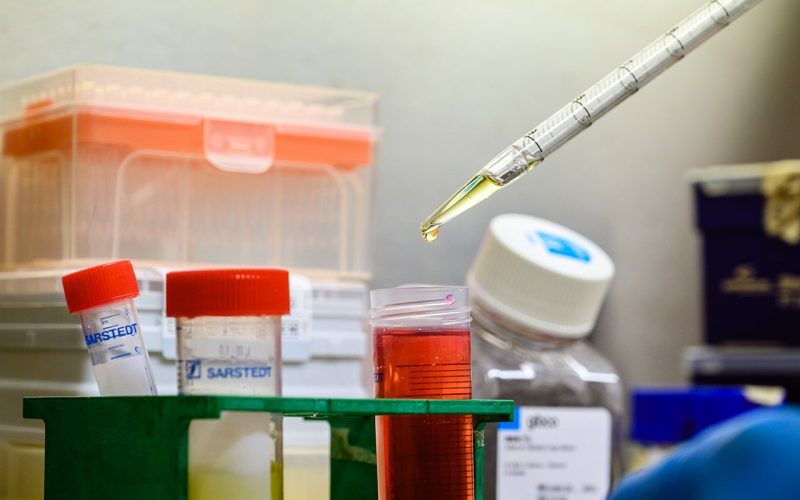 Picture of a pipette in a laboratorium