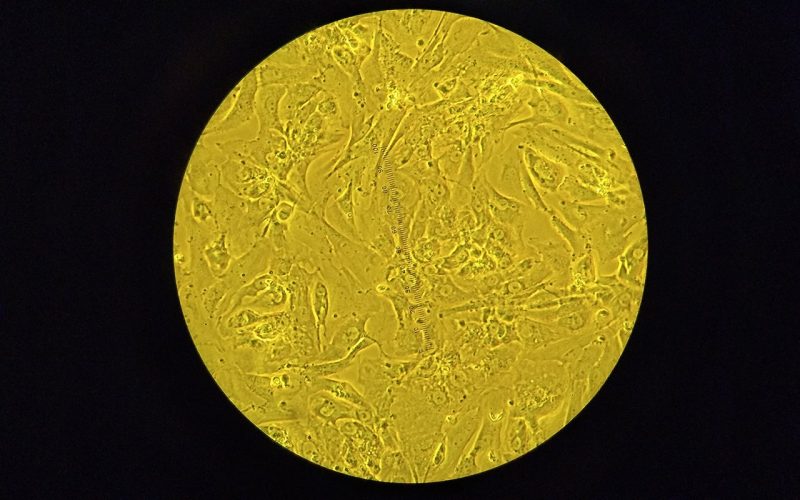 Heart muscle cell under microscope