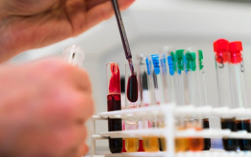 Scientist pipetting blood into tubes