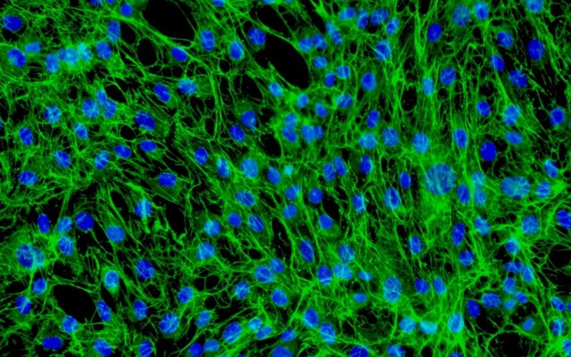 Microscopic image of dermal fibroblasts