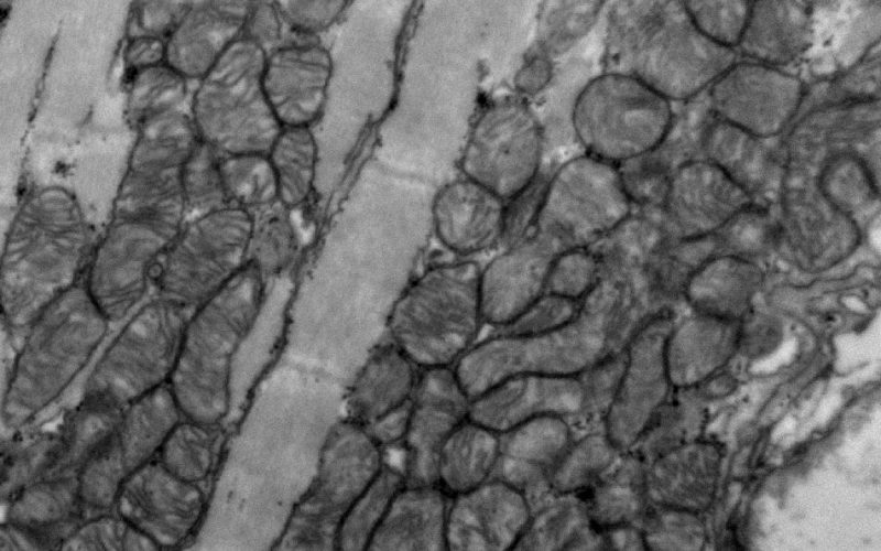 Microscopic image myocardium