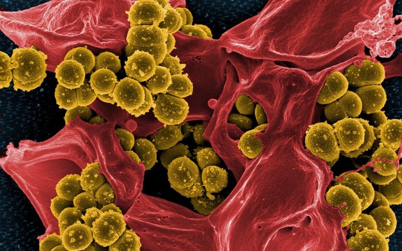Image of Staphylococcus Aureus