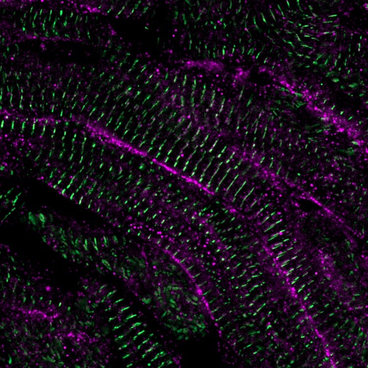 zebrafish heart muscle under the microscope