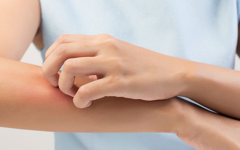 Someone scratching their arm