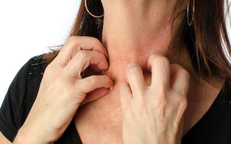 Picture of women scratching her neck
