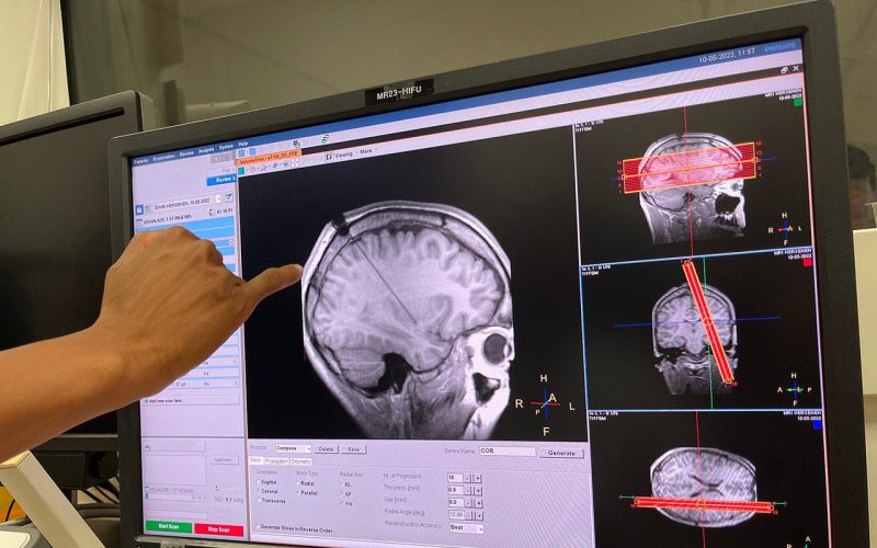 Finger pointing at a brain scan at a computer screen