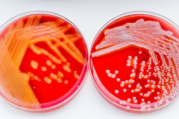Staphylococcus aureus in a petri dish