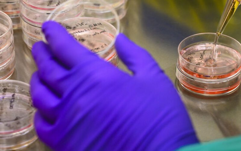Organoids in a Petri dish