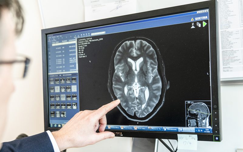 Geert Jan Biessels interprets a brain scan