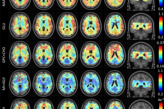Header Metabolic imaging brain and body (1H, 31P, 2H)