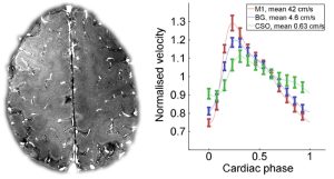 Vascular pulsatility and distensibility measurements