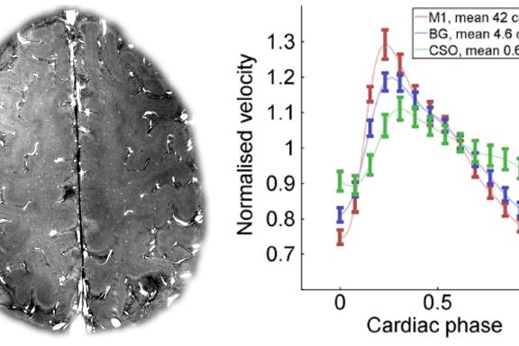 Vascular pulsatility and distensibility measurements