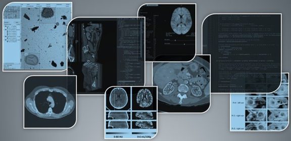 Header Image analysis & quantitative imaging tooling