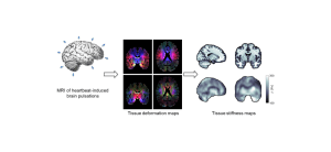 Seismology of the Brain