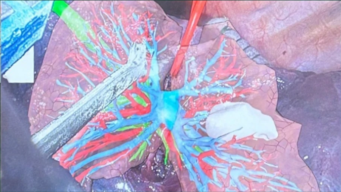 Augmented Surgical Reality