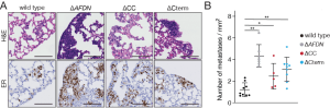 ER cells in lung