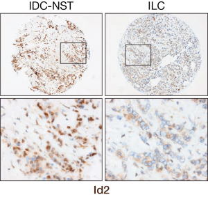 TMA example_ID2