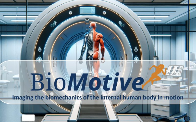 Illustration of “walk-in” MRI scanner at UMC Utrecht, enabling imaging during motion.