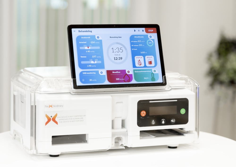 A Neokidney portable dialysis device.