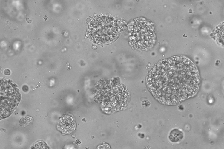 organoids