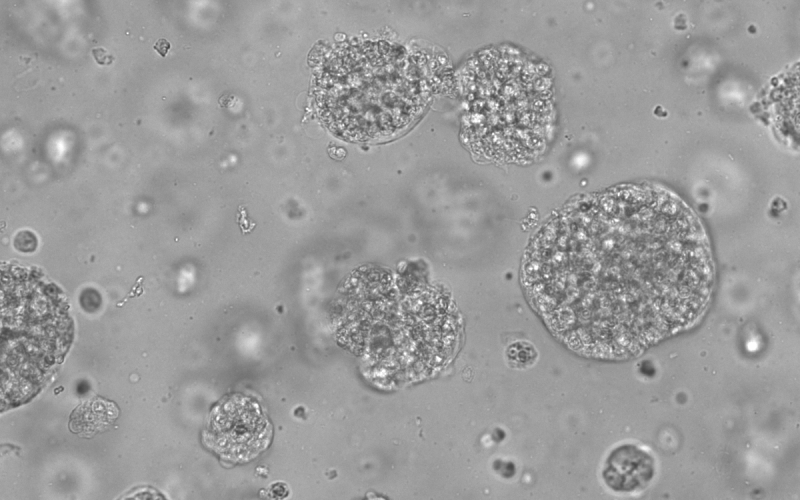 organoids