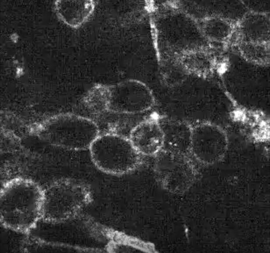 Untreated cells - in white the 'target' protein on te cell surface.