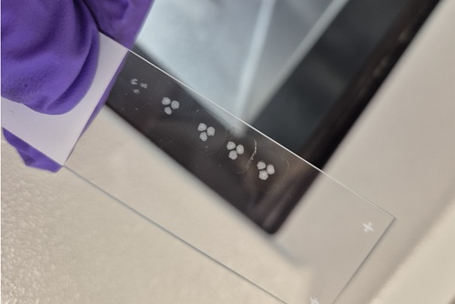 Lab-grown brain organoids on a glass slide. Photo by D.C.N. van der Heijden (Denise).
