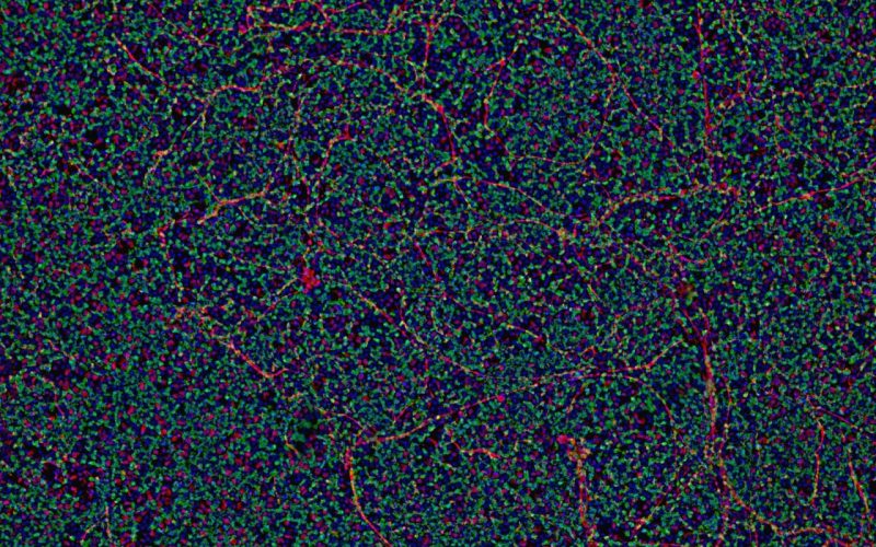Mucociliary Differentiated airway Epithelial Cells